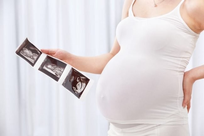 pengapuran plasenta, kalsifikasi plasenta, risiko pengapuran plasenta, pengapuran plasenta pada ibu hamil, cara mencegah pengapuran plasenta, Bunda, si Kecil